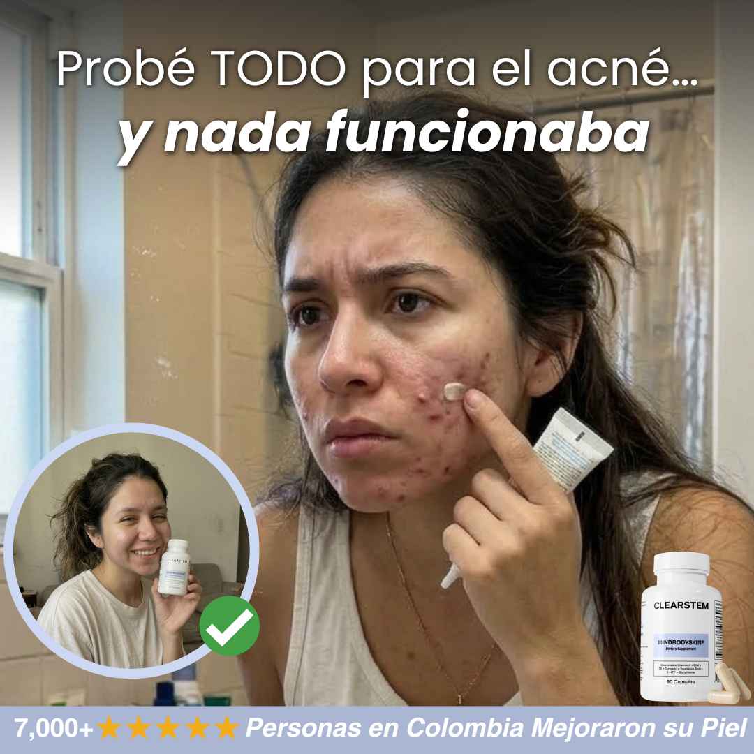 CLEARSTEAM CONTROL ACNE X90