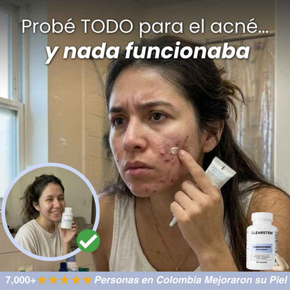 CLEARSTEAM CONTROL ACNE X90